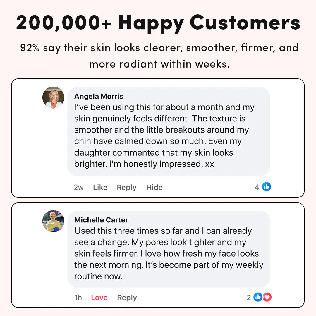 LUNA&SKIN High Frequency Therapy Wand