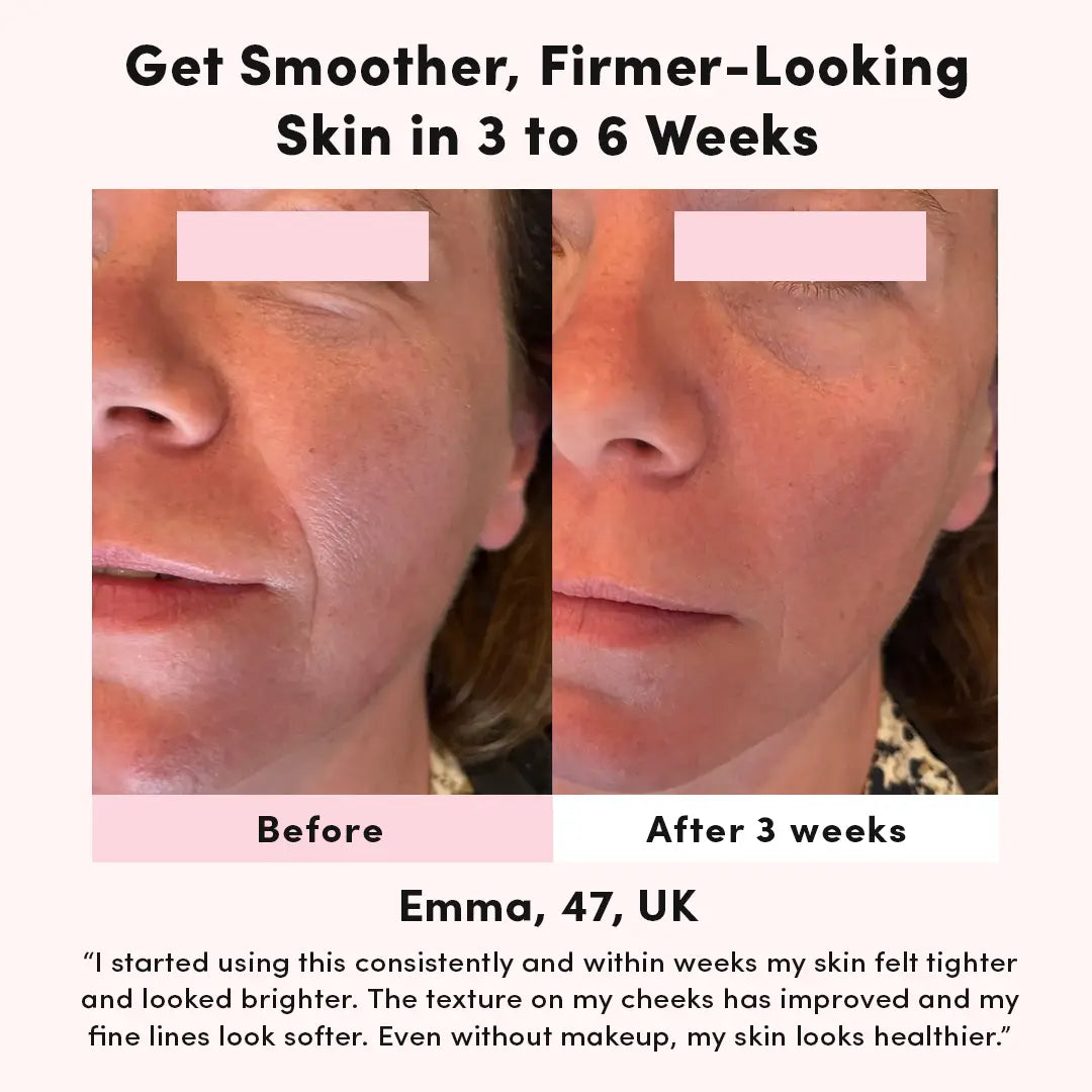 LUNA&SKIN High Frequency Therapy Wand