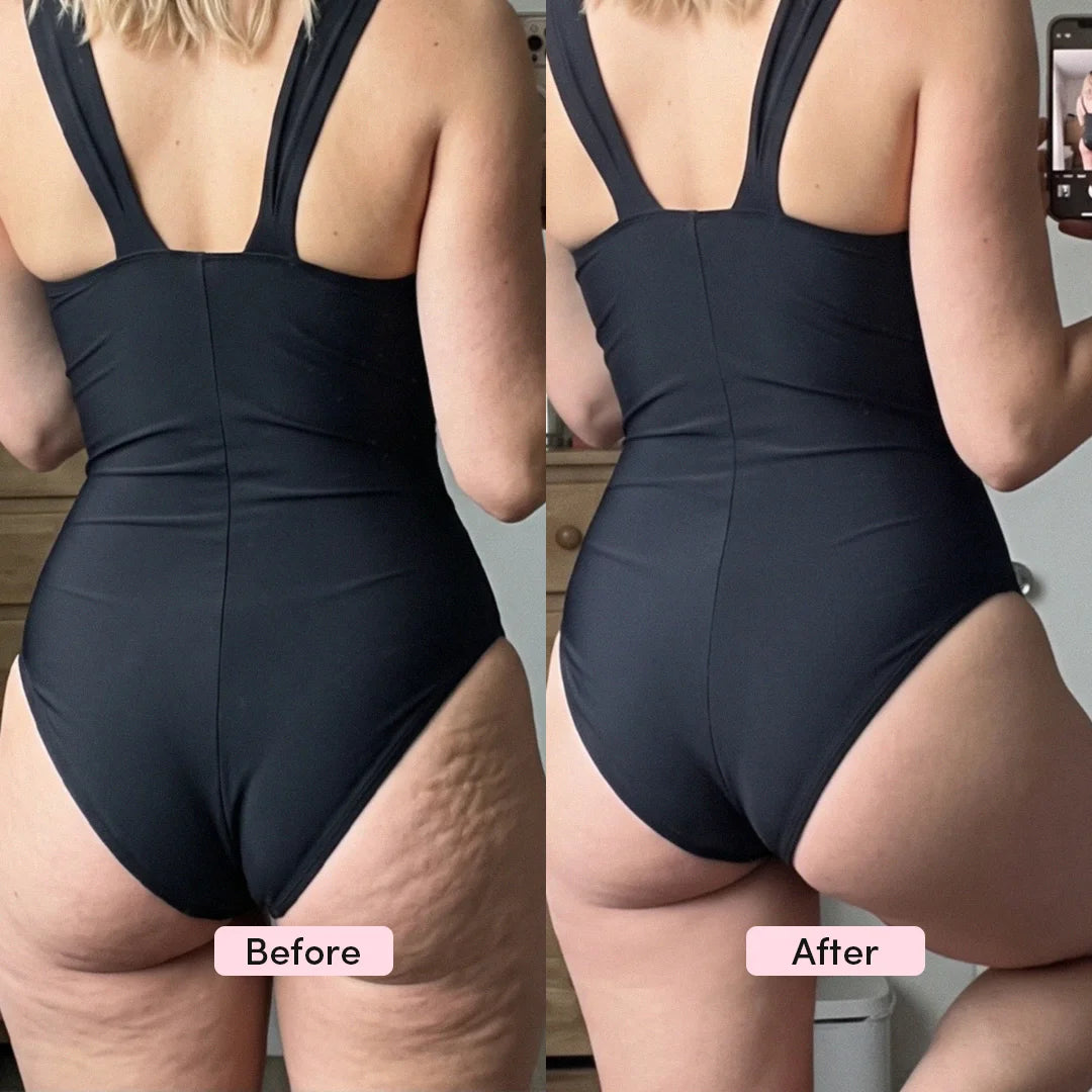 LumiSculpt™ 3-in-1 Body Sculptor
