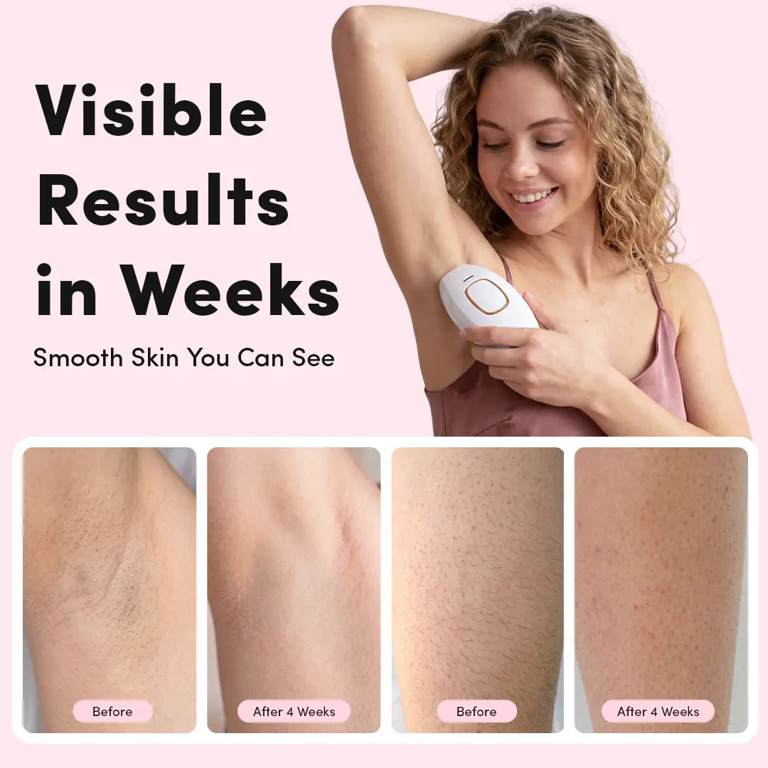 LUNA&SKIN SilkSkin™