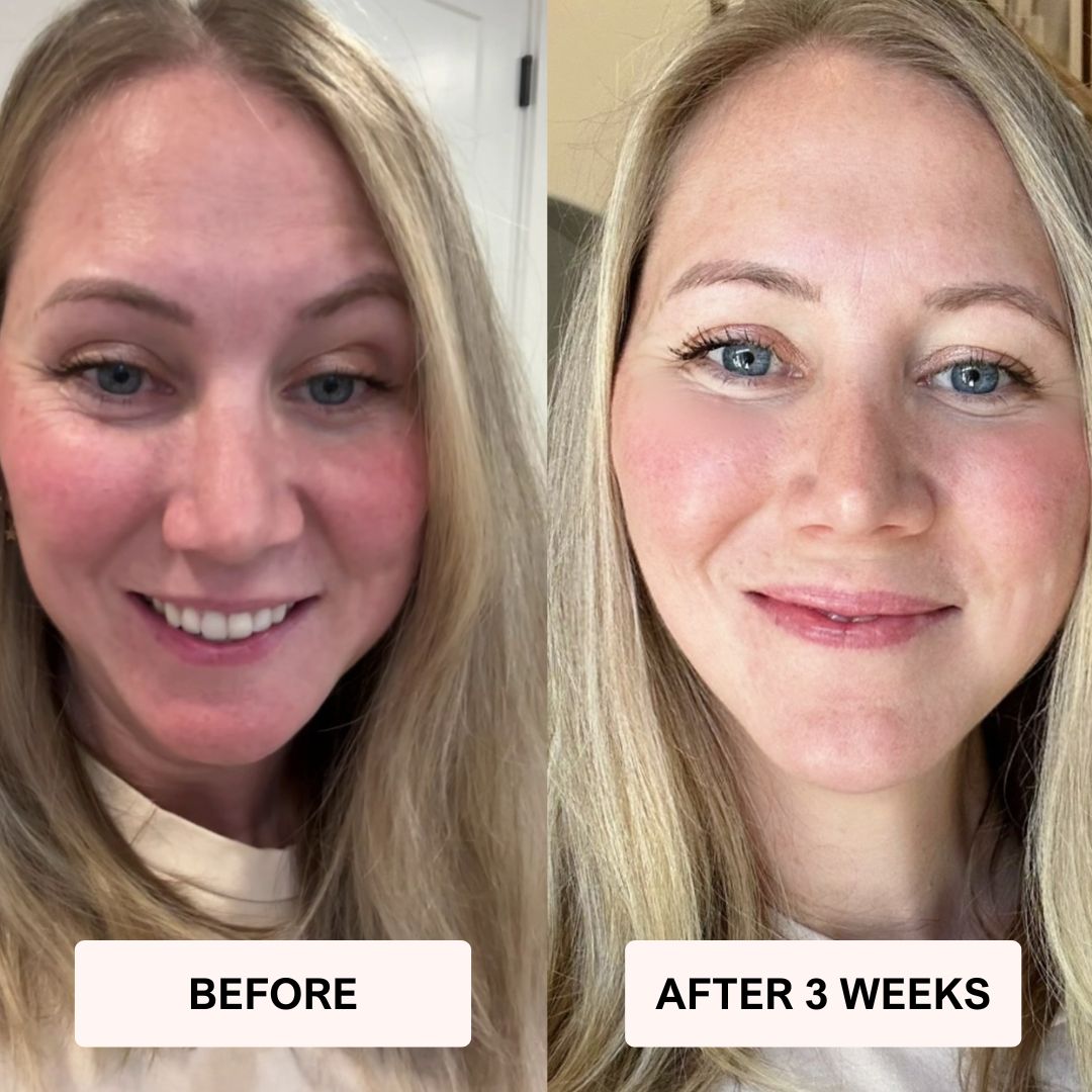 LUNA&SKIN RegenMask™